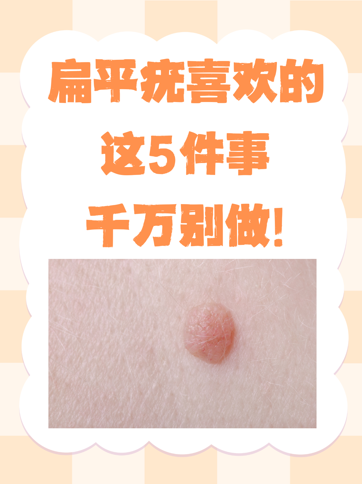 被忽视的男性HPV患者